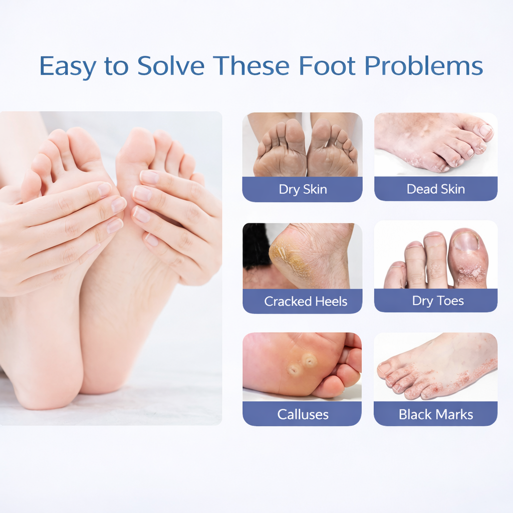 SADOER Goat Milk Exfoliating Foot Mask – Deep Moisturizing & Dead Skin Removal (1 Pair)